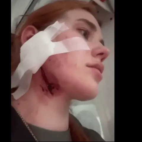 Напад у Вроцлаві через акцент: як захиститися та що робити