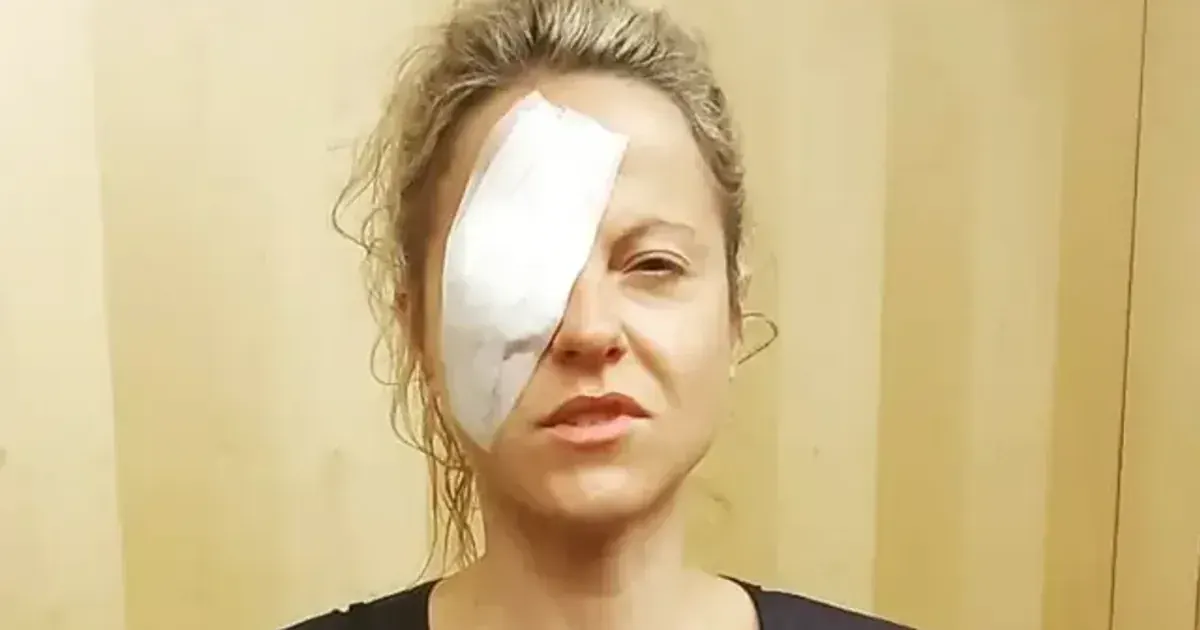 Мерехтіння в очах виявилося раком: історія жінки, яка не здається