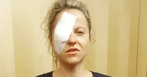 Мерехтіння в очах виявилося раком: історія жінки, яка не здається